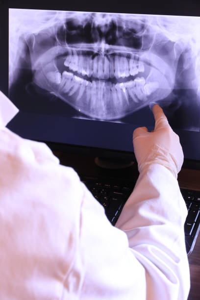 Best Emergency Tooth Extraction in North Warren, PA
